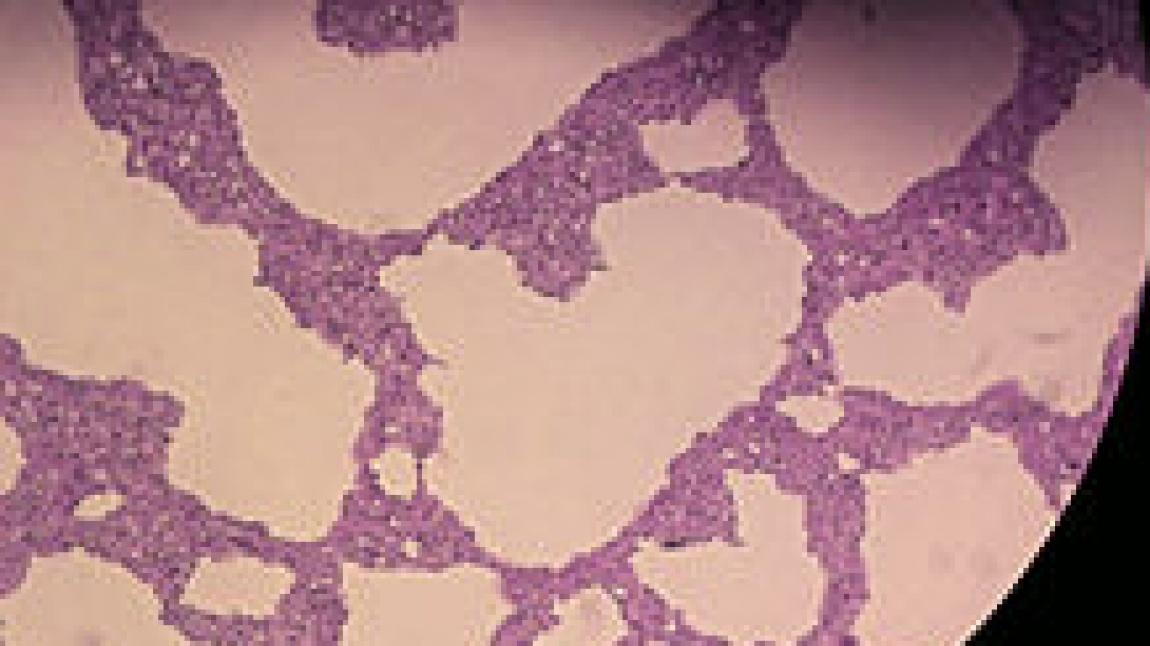 Rhodotorula Spp